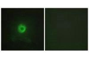 Immunofluorescence (IF) image for anti-Tumor Necrosis Factor Receptor Superfamily, Member 1B (TNFRSF1B) (C-Term) antibody (ABIN7180270)