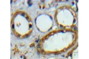 Used in DAB staining on fromalin fixed paraffin-embedded Kidney tissue (CD3D 抗体  (AA 18-113))