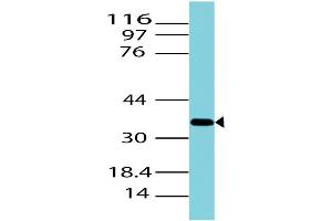 Image no. 1 for anti-Arginase (ARG) (AA 4-230) antibody (ABIN5027038) (ARG 抗体  (AA 4-230))