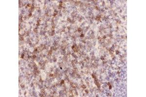 IHC-P: CD43 antibody testing of mouse spleen tissue (CD43 抗体  (AA 272-400))