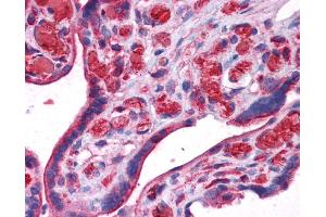 UCHL3 antibody was used for immunohistochemistry at a concentration of 4-8 ug/ml. (UCHL3 抗体)