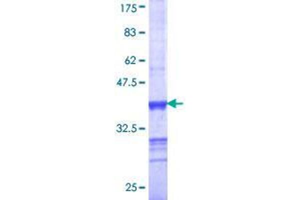 BIN3 Protein (AA 154-253) (GST tag)