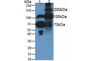 Western blot analysis of (1) Human Serum and (2) Rat Placenta Tissue (Fibulin 1 抗体  (AA 176-398))