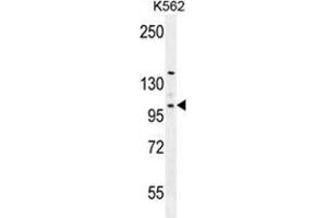 VILL Antibody (Center) western blot analysis in K562 cell line lysates (35 µg/lane). (VILL 抗体  (Middle Region))