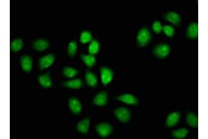 Immunofluorescence staining of Hela cells with ABIN7153843 at 1:133, counter-stained with DAPI. (GANP 抗体  (AA 292-435))