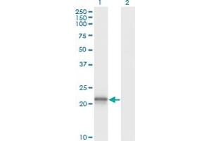 Western Blot analysis of VHL expression in transfected 293T cell line by VHL monoclonal antibody (M01), clone 1G12. (VHL 抗体  (AA 1-110))