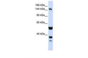Image no. 1 for anti-ABI Family, Member 3 (NESH) Binding Protein (ABI3BP) (AA 144-193) antibody (ABIN6738309) (ABI3BP 抗体  (AA 144-193))
