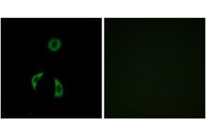 Immunofluorescence analysis of A549 cells, using FZD3 Antibody. (FZD3 抗体  (AA 481-530))