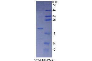 SDS-PAGE analysis of Human POMP Protein. (POMP 蛋白)