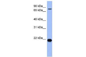 WB Suggested Anti-ZNF800 Antibody Titration:  0. (ZNF800 抗体  (N-Term))