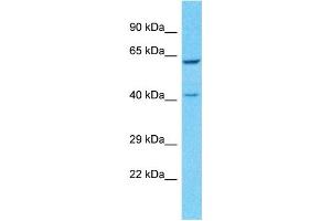 Host:  Rabbit  Target Name:  PSG8  Sample Tissue:  Human Lung Tumor  Antibody Dilution:  1ug/ml (PSG8 抗体  (C-Term))