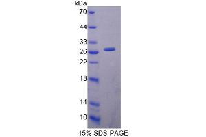 SDS-PAGE analysis of Mouse LYPLA1 Protein. (LYPLA1 蛋白)