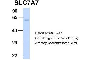 Western Blotting (WB) image for anti-Solute Carrier Family 7 (Amino Acid Transporter Light Chain, Y+L System), Member 7 (Slc7a7) (Middle Region) antibody (ABIN2781597)