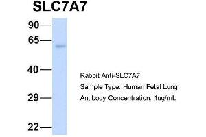 Host:  Rabbit  Target Name:  SLC7A7  Sample Type:  Human Fetal Lung  Antibody Dilution:  1.