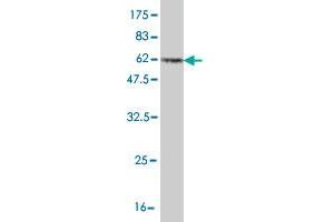 Western Blotting (WB) image for anti-Proliferating Cell Nuclear Antigen (PCNA) (AA 1-261) antibody (ABIN562136)