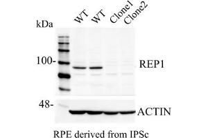 Western Blotting (WB) image for anti-Choroideremia (Rab Escort Protein 1) (CHM) (C-Term) antibody (ABIN6254222) (CHM 抗体  (C-Term))