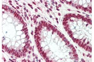 Immunohistochemistry (IHC) image for anti-Poly-U Binding Splicing Factor 60KDa (PUF60) (C-Term) antibody (ABIN2779054)
