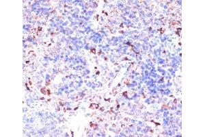 Immunohistochemistry (Paraffin-embedded Sections) (IHC (p)) image for anti-Glycine Amidinotransferase (L-Arginine:glycine Amidinotransferase) (GATM) antibody (ABIN7262473)