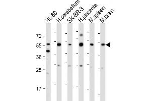 Western Blotting (WB) image for anti-Choline/ethanolamine phosphotransferase 1 (CEPT1) (AA 29-57), (N-Term) antibody (ABIN654330)
