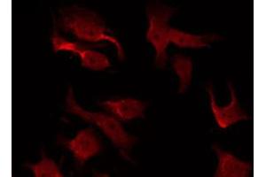 ABIN6267473 staining Hela by IF/ICC. (AKT1 抗体  (pThr308))