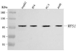 Western blot analysis of WFS1 using anti-WFS1 antibody (ABIN7601043).