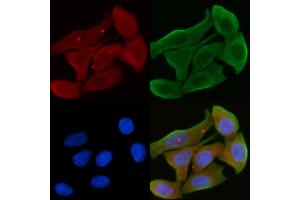 anti-Ubiquitin Protein Ligase E3B (UBE3B) (C-Term) antibody