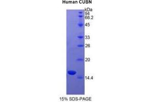 SDS-PAGE analysis of Human Cubilin Protein. (CUBN 蛋白)