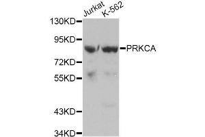 Western blot analysis of extracts of various cell lines, using PRKCA antibody. (PKC alpha 抗体  (C-Term))