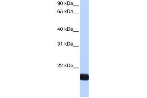 WB Suggested Anti-CTF1 Antibody Titration: 0.