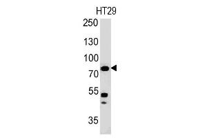 Western Blotting (WB) image for anti-Moesin (MSN) antibody (ABIN6940082)
