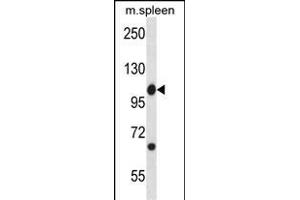 Mouse Abl1 Antibody (Center) (ABIN657828 and ABIN2846795) western blot analysis in mouse spleen tissue lysates (35 μg/lane). (ABL1 抗体  (AA 613-641))