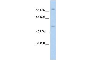 WB Suggested Anti-NR3C1 AntibodyTitration: 1. (Glucocorticoid Receptor 抗体  (N-Term))
