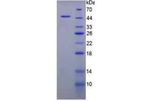 SDS-PAGE of Protein Standard from the Kit  (Highly purified E. (MUC1 ELISA 试剂盒)