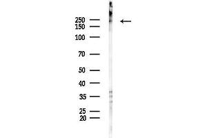 Western blot analysis of lysates from Mouse lung, using MYH3 Antibody at 1/1000 dilution.