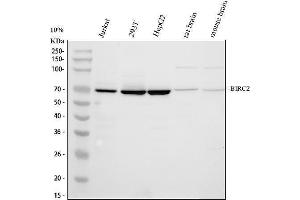 Western blot analysis of cIAP1/BIRC2 using anti-cIAP1/BIRC2 antibody (ABIN5693185). (BIRC2 抗体  (AA 320-570))
