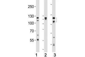 Western blot analysis of lysate from (1) HeLa, (2) K562 and (3) T47D cell line using FGFR2 antibody at 1:1000.