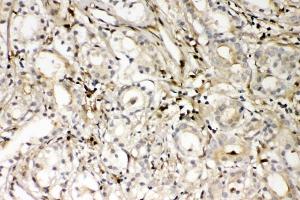 IHC analysis of S100A4 using anti-S100A4 antibody (ABIN7600462). (s100a4 抗体  (AA 2-101))