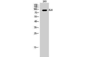 Western Blotting (WB) image for anti-Immunoglobulin kappa Variable 1-27 (IGKV1-27) (Internal Region) antibody (ABIN3173607) (IGKV1-27 抗体  (Internal Region))