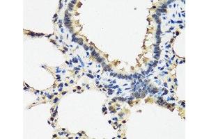 Immunohistochemistry of paraffin-embedded Rat lung using ARSF Polyclonal Antibody at dilution of 1:100 (40x lens). (ARSF 抗体)