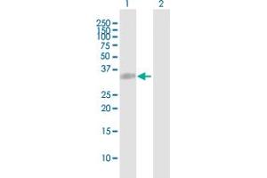 Western Blot analysis of COL23A1 expression in transfected 293T cell line by COL23A1 MaxPab polyclonal antibody. (COL23A1 抗体  (AA 1-309))