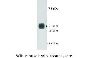 Image no. 1 for anti-Transmembrane Protein 132A (TMEM132A) antibody (ABIN1112938) (TMEM132A 抗体)