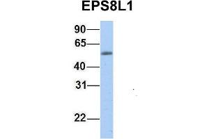 Western Blotting (WB) image for anti-EPS8-Like 1 (EPS8L1) (Middle Region) antibody (ABIN2775448)