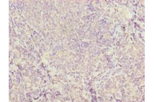 Immunohistochemistry of paraffin-embedded human tonsil tissue using ABIN7177453 at dilution of 1:100