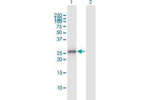 Western Blot analysis of GCLM expression in transfected 293T cell line by GCLM MaxPab polyclonal antibody. (GCLM 抗体  (AA 1-274))