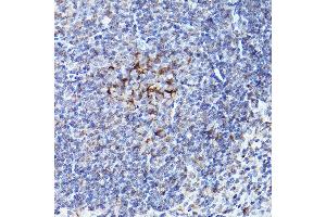 Immunohistochemistry of paraffin-embedded mouse spleen using BOK Rabbit pAb (ABIN7265866) at dilution of 1:100 (40x lens). (BOK 抗体  (AA 1-100))