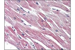 Immunohistochemistry: EPHX2 antibody staining of Formalin-Fixed, Paraffin-Embedded Human Heart. (EPHX2 抗体  (C-Term))