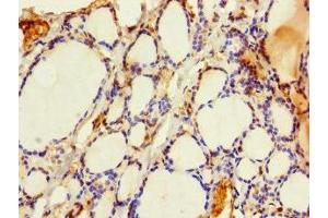 Immunohistochemistry of paraffin-embedded human thyroid tissue using ABIN7164255 at dilution of 1:100 (SLMO2 抗体  (AA 1-194))