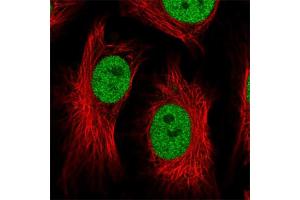 Immunofluorescent staining of human cell line HeLa with ATF1 polyclonal antibody  at 1-4 ug/mL concentration shows positivity in nucleus but excluded from the nucleoli. (AFT1 抗体)