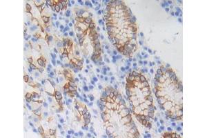 Immunohistochemistry (IHC) image for anti-Solute Carrier Family 20 (Phosphate Transporter), Member 1 (SLC20A1) (AA 251-510) antibody (ABIN7445384)