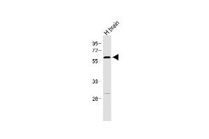 Anti-RORA Antibody  at 1:500 dilution + Human brain lysate Lysates/proteins at 20 μg per lane. (RORA 抗体  (AA 193-222))